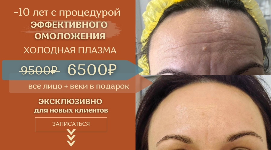 Студия здорового омоложения «Время»: Эстетическая косметология нового уровня